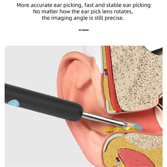 Bebird R1 Ear Cleaner with Camera Earpick Tool
